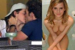 Emma Watson Nude Photos With Her Boyfriend Leaked! on fangals.org