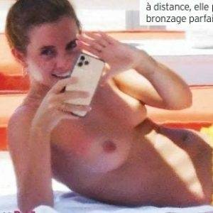 EMMA WATSON TOPLESS NUDE SUNBATHING PHOTOS PUBLISHED IN FRANCE thothub - France on fangals.org